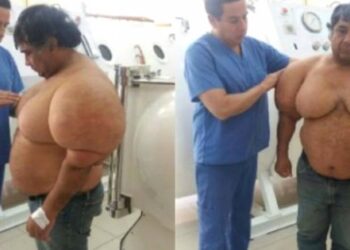 Denize daldı, tanınmaz halde çıktı! Vücudu hava doldu…