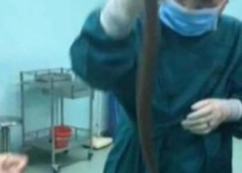 İçinden çıkanı görünce doktorlar şaşkına döndü