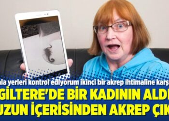 İngiltere’de bir kadının aldığı muzun içerisinden akrep çıktı