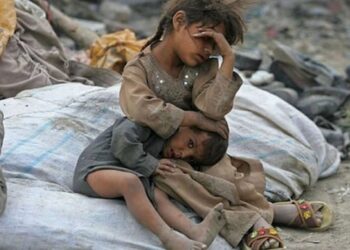 Yemen’de ‘1 milyon çocuk daha açlık tehdidi altına girdi’