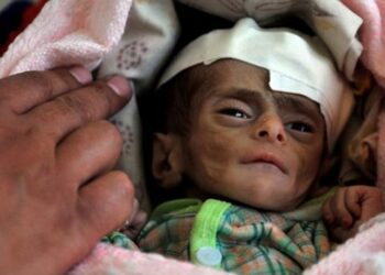Yemen’de 14 milyon insan açlıktan ölme riski ile karşı karşıya