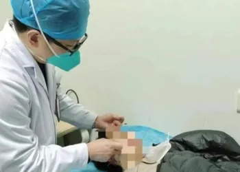 Dünya Kupası maçlarını takip etmek için uykusuz kaldı; yüz felci geçirdi