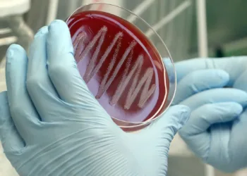 Strep A belirtileri neler, bakteri hangi hastalıklara yol açıyor?