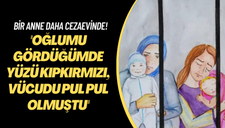 Bir anne daha cezaevinde! Oğlumu gördüğümde yüzü kıpkırmızı, vücudu pul pul olmuştu