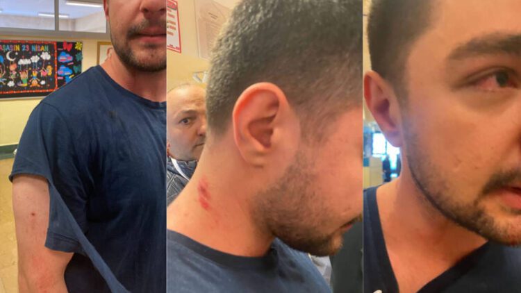 İstanbul’da AKP’li müşahitler TİP üyesine saldırdı