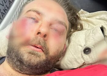 Afişleri indiren CHP’liye Gökçek’in adamları saldırmış