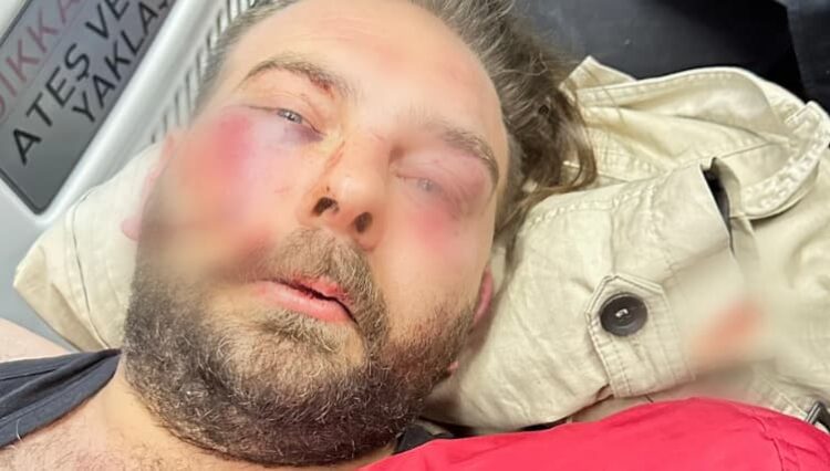 Afişleri indiren CHP’liye Gökçek’in adamları saldırmış