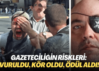 Gazeteciliğin riskleri: Vuruldu, kör oldu, ödül aldı!