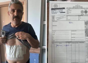 Şanlıurfa’da blok oy kullanıma karşı çıkan sandık görevlisi kaynar suyla yakıldı