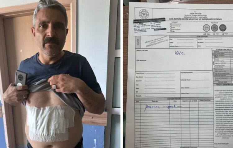 Şanlıurfa’da blok oy kullanıma karşı çıkan sandık görevlisi kaynar suyla yakıldı