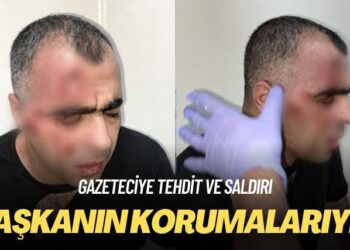Gazeteciye tehdit ve saldırı: Başkanının korumalarıydı