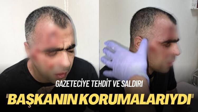 Gazeteciye tehdit ve saldırı: Başkanının korumalarıydı
