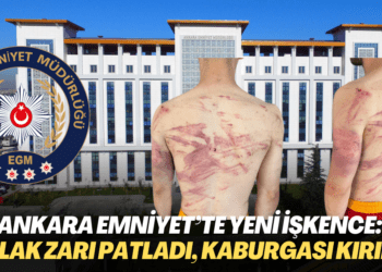 Ankara Emniyet’te yeni işkence: Kulak zarı patladı, kaburgası kırıldı