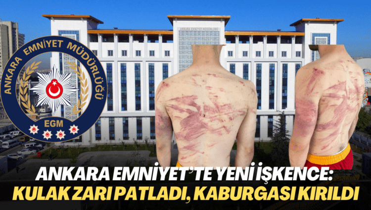 Ankara Emniyet’te yeni işkence: Kulak zarı patladı, kaburgası kırıldı