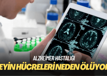 Bilim insanları Alzheimer hastalarında beyin hücrelerinin neden öldüğünü keşfetti