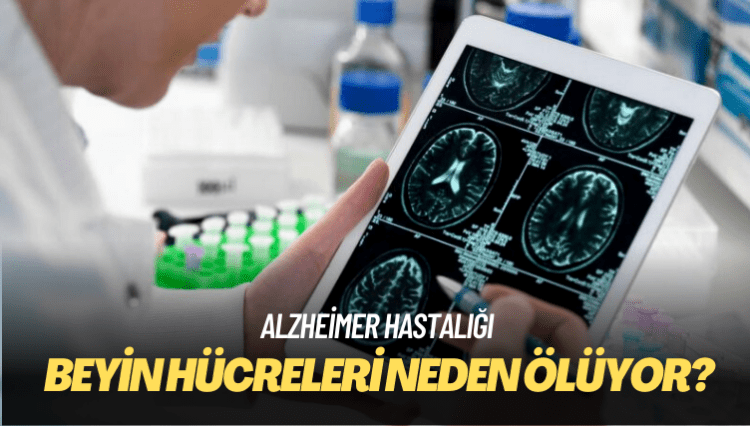 Bilim insanları Alzheimer hastalarında beyin hücrelerinin neden öldüğünü keşfetti