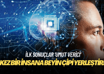 Neuralink’in beyin çipi ilk kez bir insana yerleştirildi