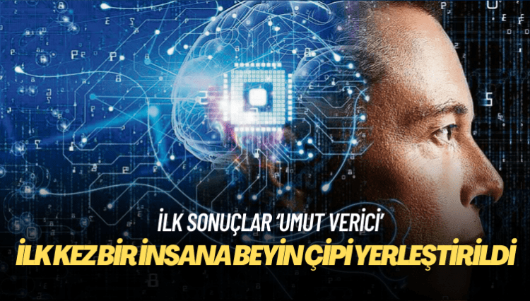 Neuralink’in beyin çipi ilk kez bir insana yerleştirildi