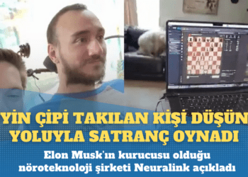 Beyin çipi yerleştirilen kişi düşünce yoluyla satranç oynadı