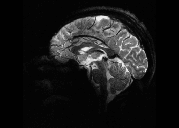 İnsan beyninin en net görüntüsü yayınlandı