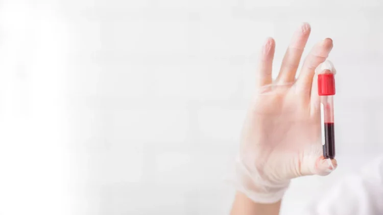 Yapay zeka ile kan tahlili Parkinson’da erken teşhise yardımcı olabilir