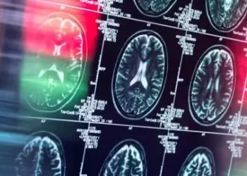 AB, ‘tarihi’ Alzheimer ilacına ruhsat vermedi