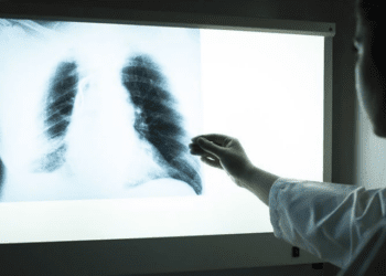 Rapor: Deprem sonrası astım ve KOAH vakaları arttı