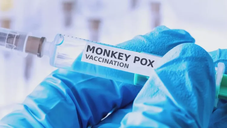 Maymun çiçeği virüsü Avrupa’ya sıçradı: İlk vaka doğrulandı