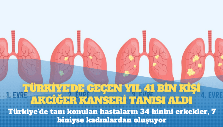 Türkiye’de geçen yıl 41 bin kişi akciğer kanseri tanısı aldı