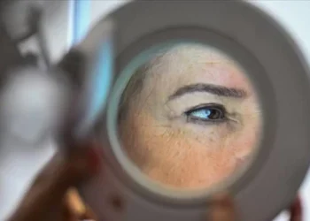 Hücre Atlası: Cildin yaşlanmasını geciktirebilecek yeni bir yöntem keşfedildi