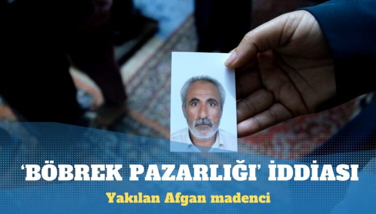 Yakılan Afgan madencinin iş arkadaşlarından ‘böbrek pazarlığı’ iddiası