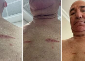 Tanal: Bu yaralar sadece bedende değil, hukuk devletinde açılmıştır