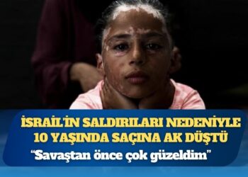 İsrail’in saldırıları nedeniyle saçlarına ak düşen Filistinli kız eski günlerine dönmek istiyor: “Savaştan önce çok güzeldim”