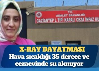 Gaziantep L Tipi Cezaevi’nin savcısından hamile kadına X-Ray dayatması