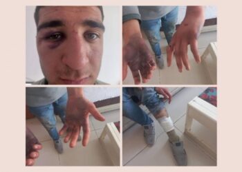 Penseli işkenceye maruz kalan tutsağın babası: Tedavisi engelleniyor