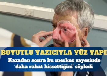 Kaza geçiren bisikletçiye üç boyutlu yazıcıyla yüz yapıldı