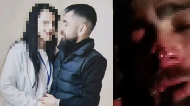 Eski sevgiliye işkence: Abisi kulağını ve burnunu kopardı