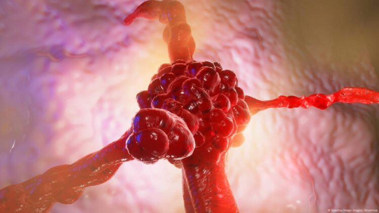 Emzirmek meme kanserine karşı nasıl koruyor?