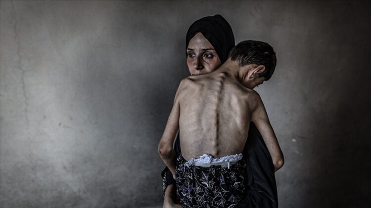 Gazze Şeridi’nde son 24 saatte 5 Filistinli daha açlıktan hayatını kaybetti