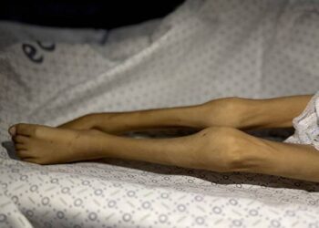 BM: Gazze’de açlıktan ölen insan haberleri sıradan bir olay haline geldi