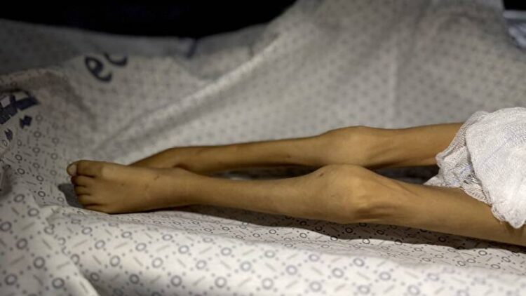 BM: Gazze’de açlıktan ölen insan haberleri sıradan bir olay haline geldi