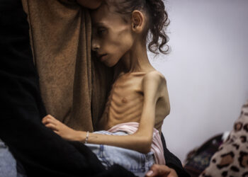 İsrail’in kıtlığa sürüklediği Gazze’de 9 yaşındaki Meryem, 25 kilodan 10 kiloya düştü