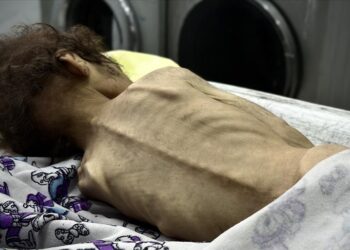 İsrail’in kıtlığı dayattığı Gazze Şeridi’nde son 24 saatte 2’si çocuk 4 kişi daha açlıktan hayatını kaybetti