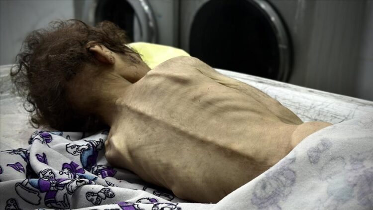 İsrail’in kıtlığı dayattığı Gazze Şeridi’nde son 24 saatte 2’si çocuk 4 kişi daha açlıktan hayatını kaybetti