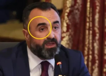 Sağ gözünü eline aldı, vekiller dondu kaldı