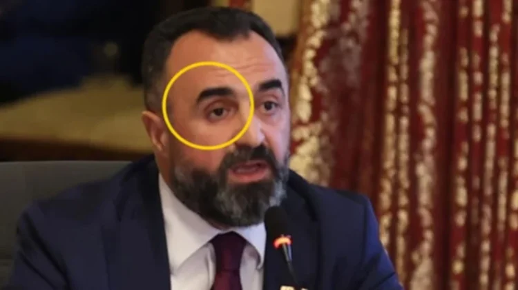 Sağ gözünü eline aldı, vekiller dondu kaldı