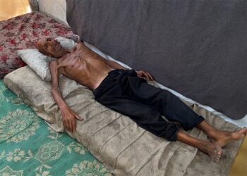 Gazze Şeridi’nde 75 yaşındaki yaşlı adam, İsrail’in dayattığı açlık nedeniyle 40 kiloya düştü
