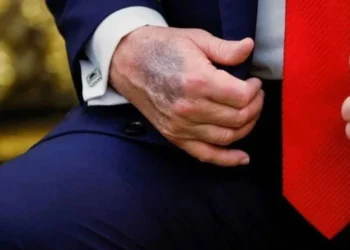 Trump’ın eli yine gündem oldu, Beyaz Saray’dan açıklama geldi