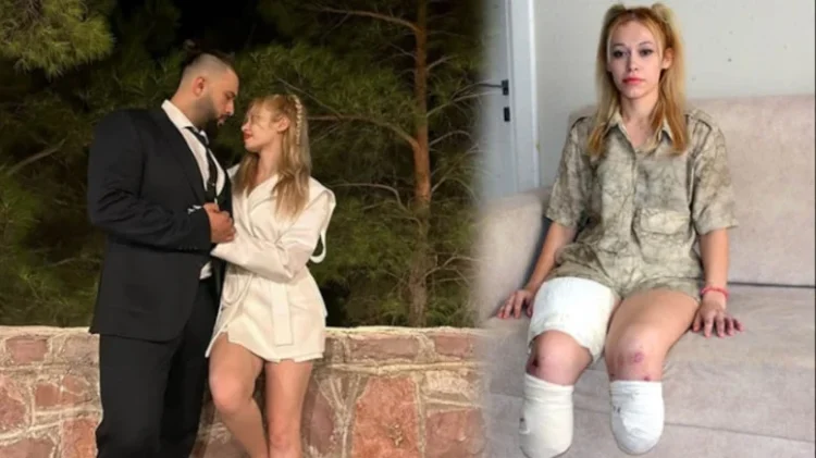 Evlilik yıl dönümünde bacaklarını kaybetti