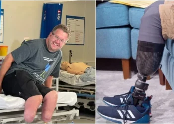 Kendi bacaklarını kesen İngiliz cerraha hapis